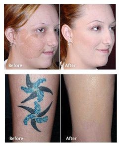 Tips for Camouflaging Skin Imperfections with Makeup