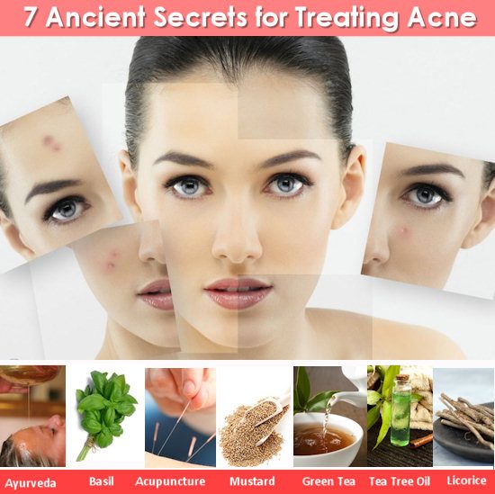 7 Ancient Secrets for Treating Acne