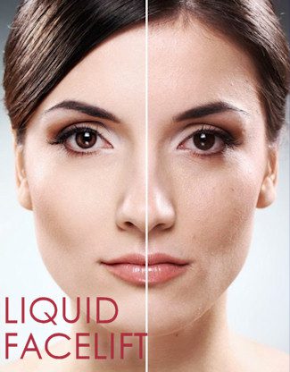 Why get a Liquid Facelift? 