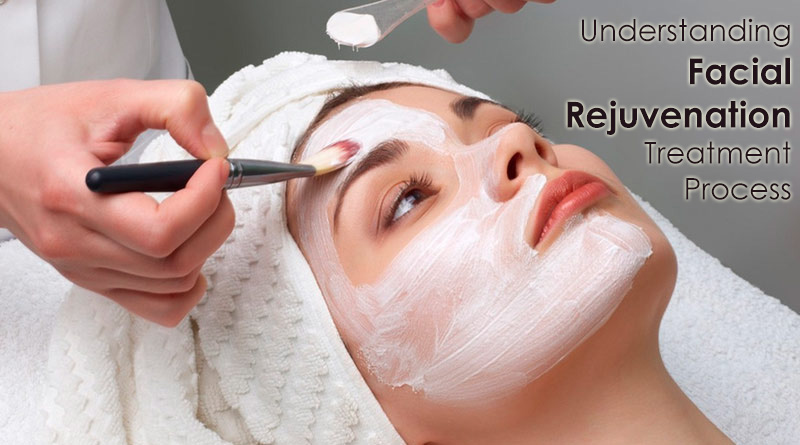 Understanding Facial Rejuvenation Treatment Process