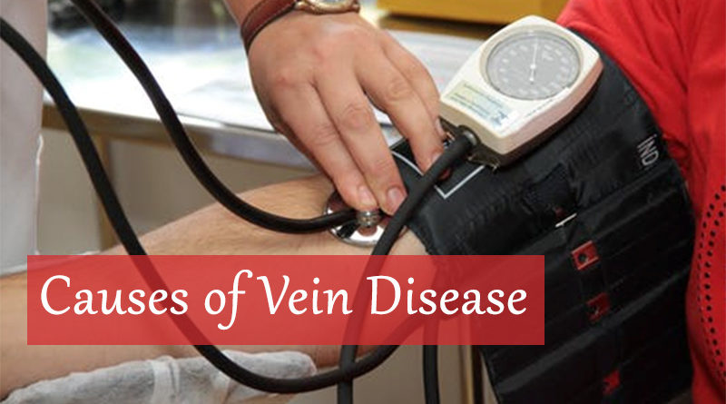 Causes of Vein Disease