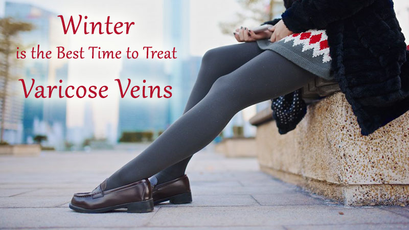 Winter is the Best Time to Treat Varicose Veins