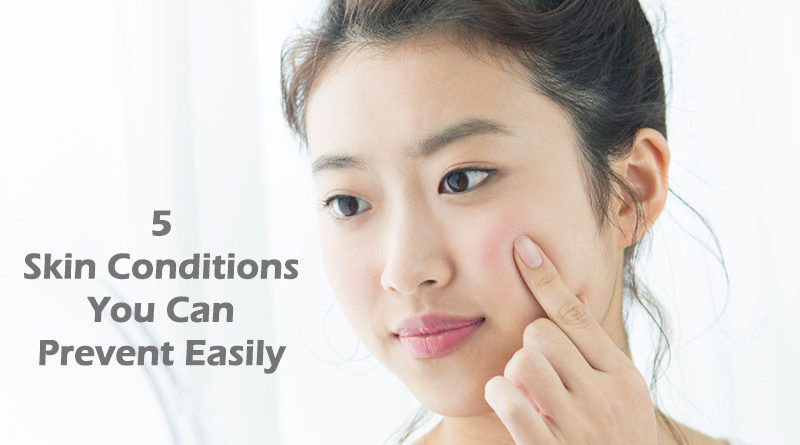 5 Skin Conditions You Can Prevent Easily