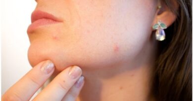 A Guide to Treating The Appearance of Acne Scars