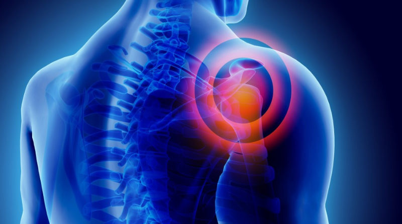 6 Most Common Musculoskeletal Injuries