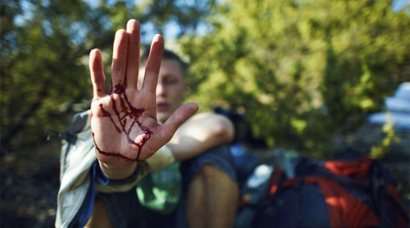 Got Injured While Camping Near Atlanta? 5 Signs You Should Visit an Orthopedic Doctor Now
