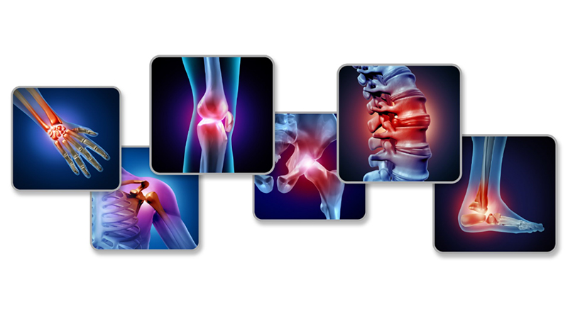 How Using CBD Oil Helps Manage Different Types Of Pain