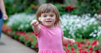 Diagnosing Turner Syndrome