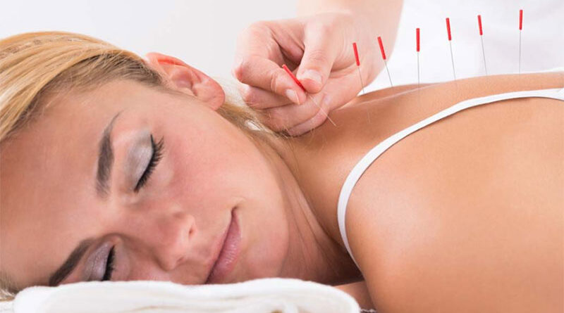 #NewMumsOnly: 6 Ways Acupuncture Is A Boon For New Mothers