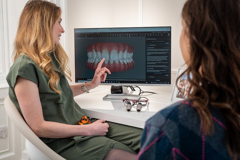 Dental Implants: A Confidence-Boosting Solution for Missing Teeth